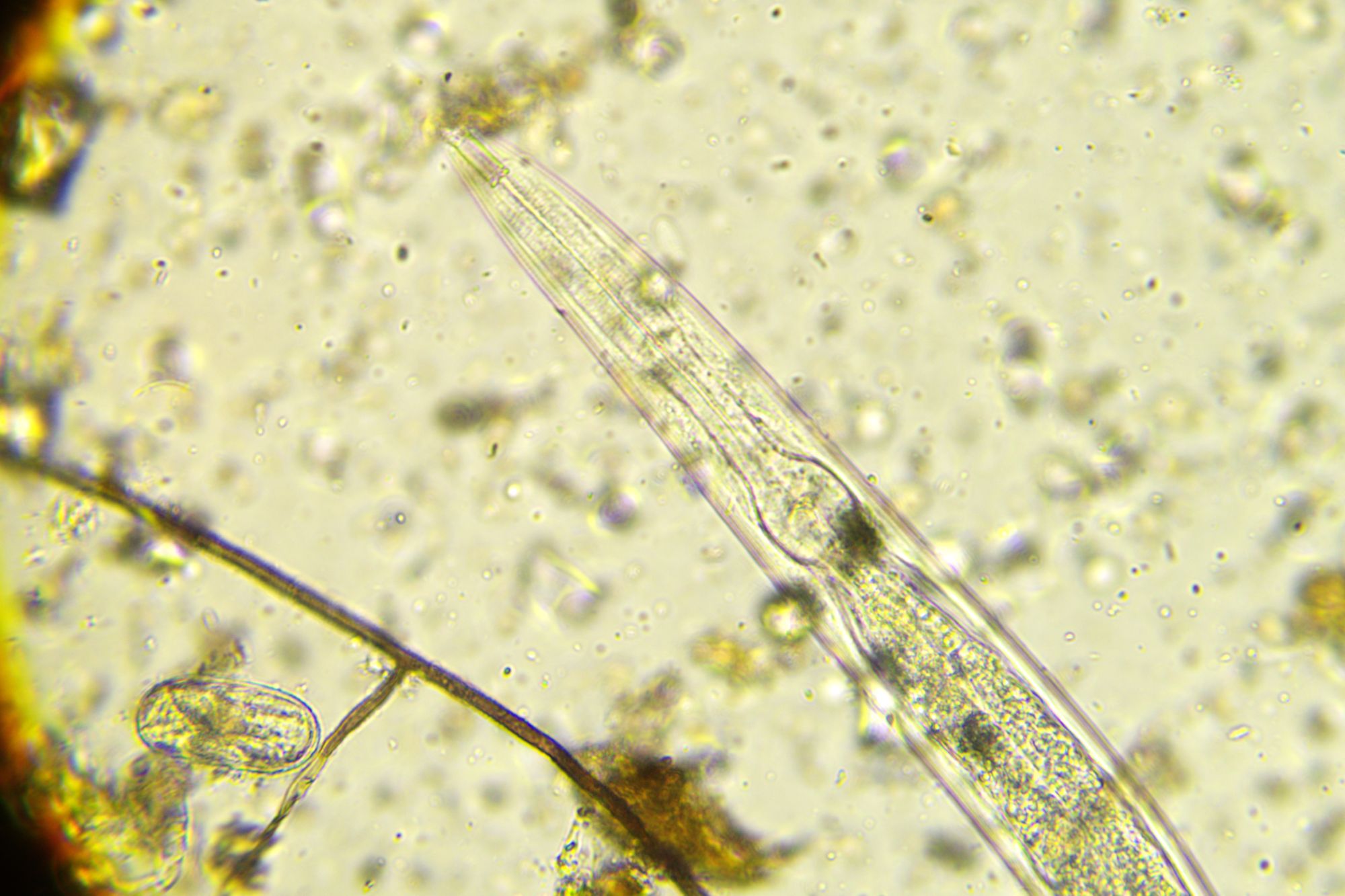 Microscope Photo